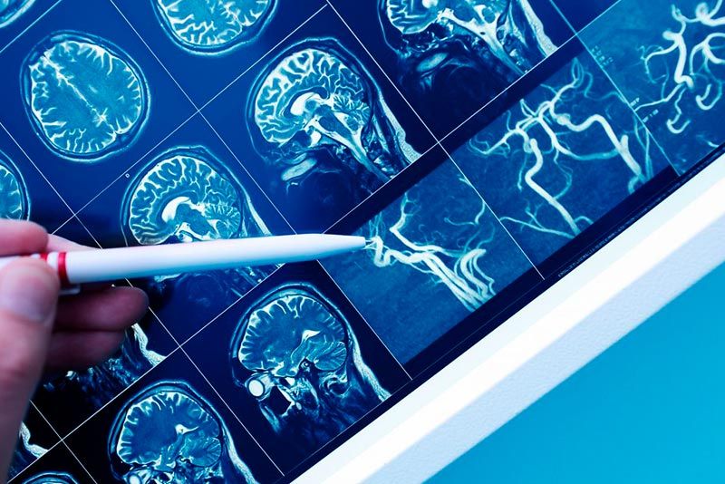 Recaudación para la investigación